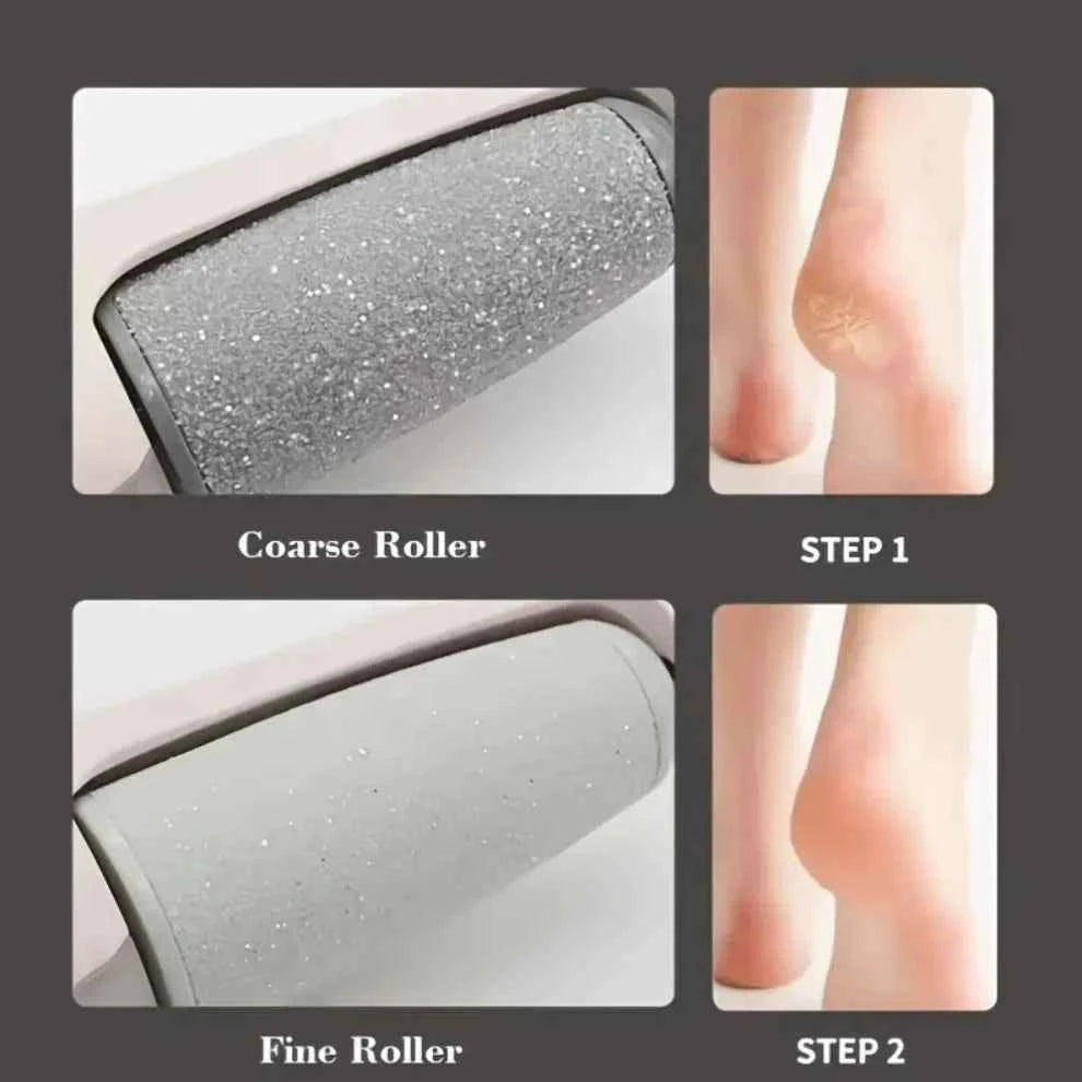 Electric Feet Callus Remover