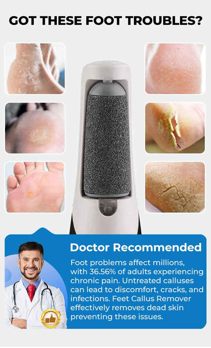Electric Feet Callus Remover