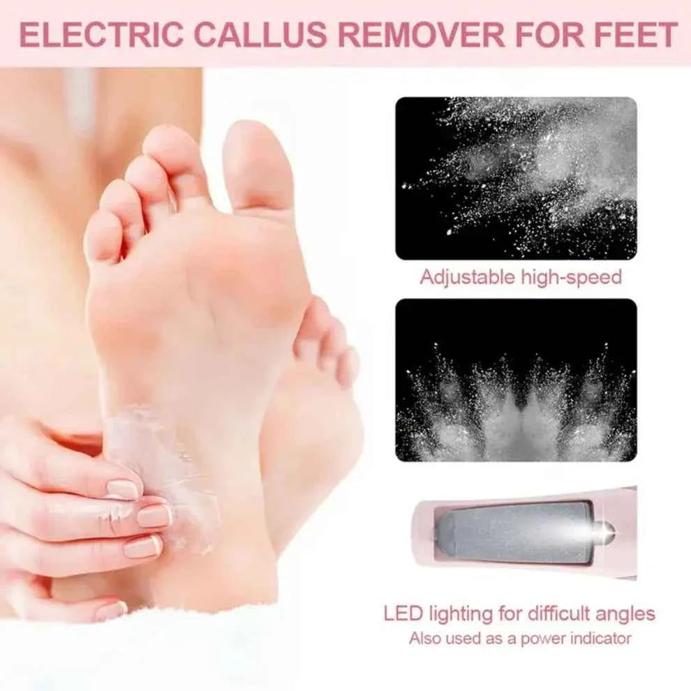 Electric Feet Callus Remover