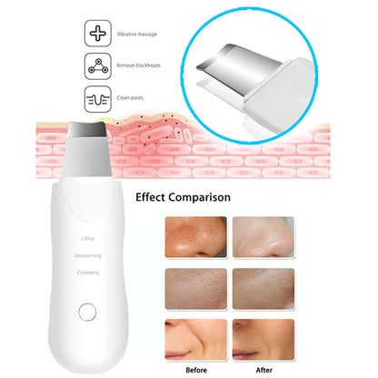 PureSonic Ultrasonic Skin Scrubber
