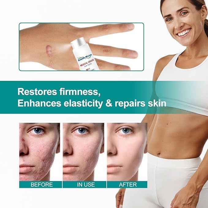 Medical Scar Removal Spray