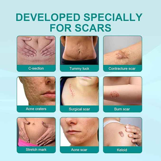 Medical Scar Removal Spray