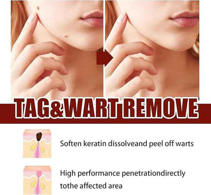 Tags and Moles Remover